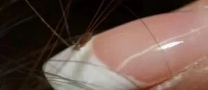 El oficio ofrecido por 1 Bs: matar piojos entre las uñas.